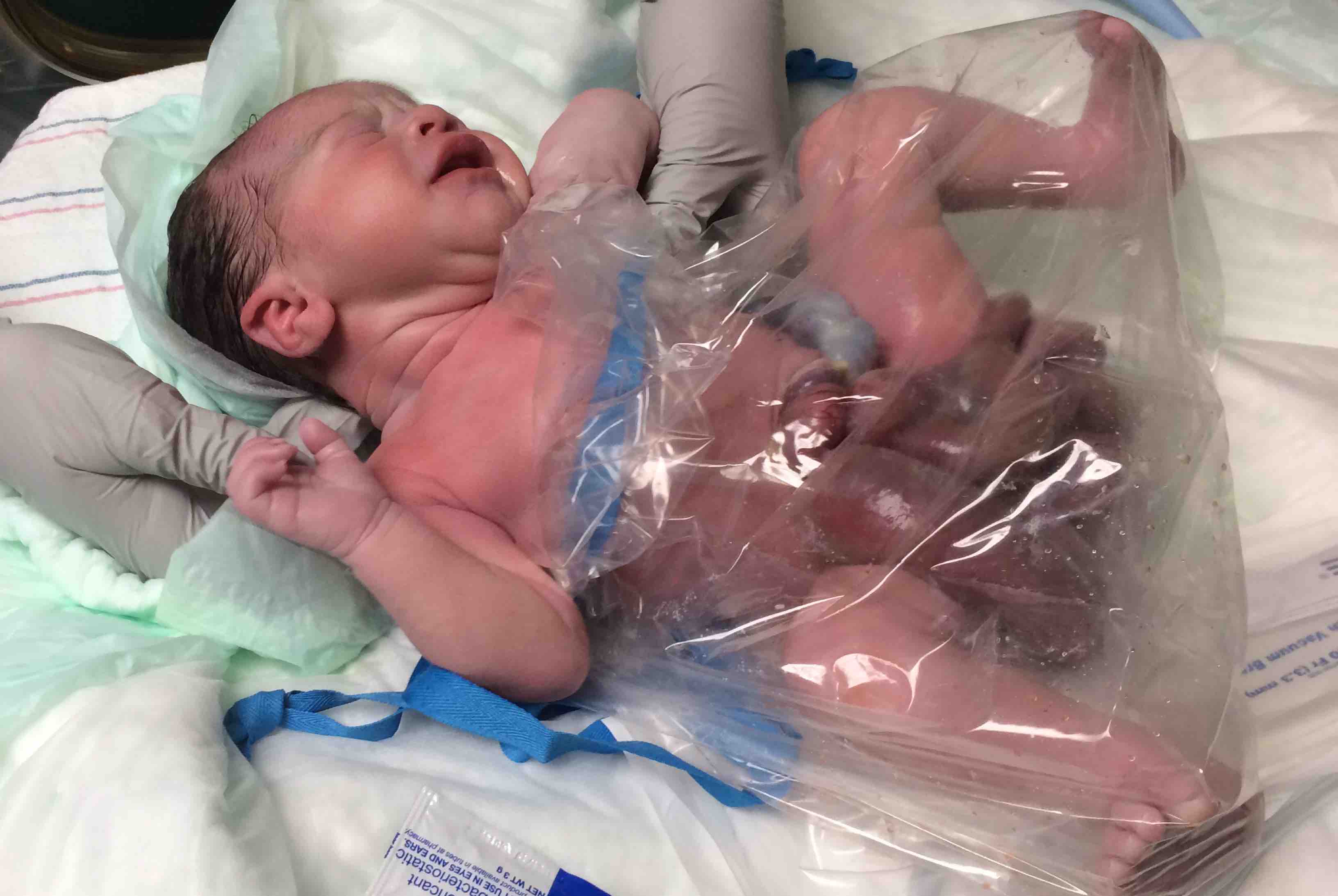 Fundraiser by Sean Christlieb Teagan's Gastroschisis Medical Fund