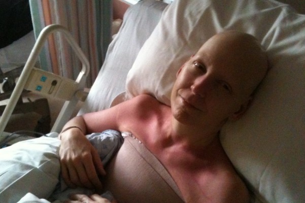 breast cancer reconstructions Breast cancer reconstructions