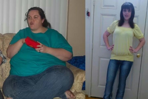 massive weight loss before and after