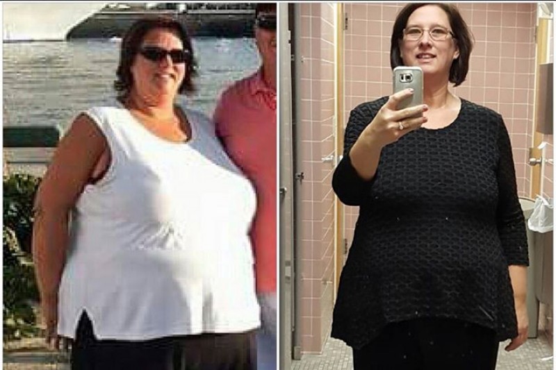 Weight gain memory loss photo 7